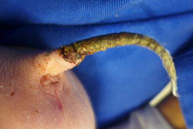 Weaner tail with scabbed area at the tip showing development of necrosis. This can be itchy. To find relief, affected pigs might put up with nibbling by others, resulting in serious tissue damage. Photo: Mirjam Lechner