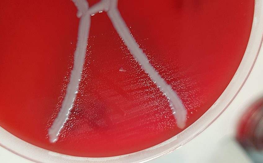 Glaesserella australis on blood plate with Staphylococcus aureus displaying satellitism. - Photo: The University of Queensland