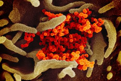This scanning electron microscope image shows SARS-CoV-2 (orange) isolated from a patient in the US, emerging from the surface of cells (brown) cultured in the lab. Illustration: NIAID-RML