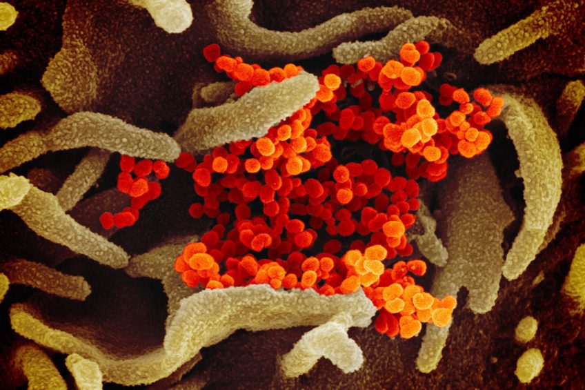 This scanning electron microscope image shows SARS-CoV-2 (orange) isolated from a patient in the US, emerging from the surface of cells (brown) cultured in the lab. Illustration: NIAID-RML