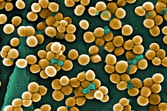 A microscopic view of MRSA bacteria. Photo: Centers for Disease Control (CDC). Photo: Centers for Disease Control (CDC)