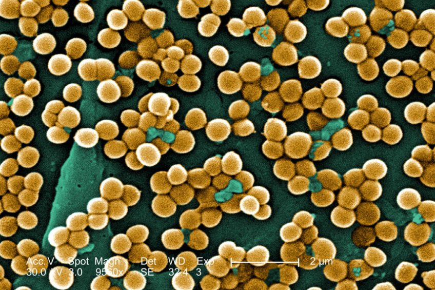 A microscopic view of methicillin-resistant Staphylococcus aureus (MRSA). Photo: CDC/ Janice Haney Carr