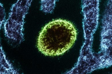 Colourised transmission electron micrograph of a Nipah Virus particle (green) near the edge of an infected cell (blue). Photo: NIAID