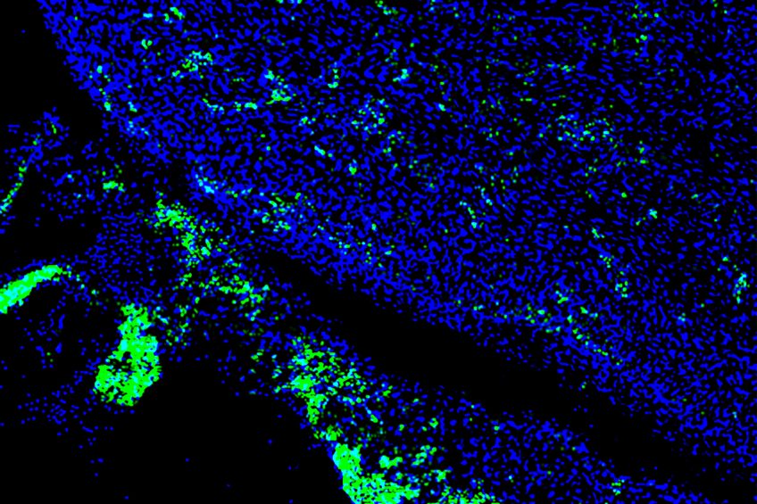 Human iPS cells (green) contributed to a developing heart of 4-week-old pig embryo. Photo: Salk Institute}