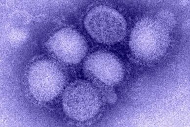 Novel influenza A virus (H1N1) photographed microscopically. - Photo: Centers for Disease Control (CDC)