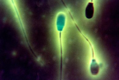 A microscope image of normal functional swine semen cells. - Photo: Henk Riswick