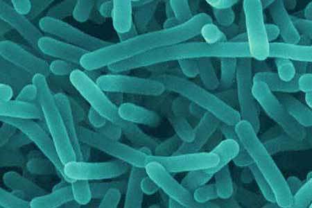 Canadian firm recalled bacon products due to listeria
