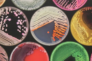 Report: Antimicrobial resistance remain an issue