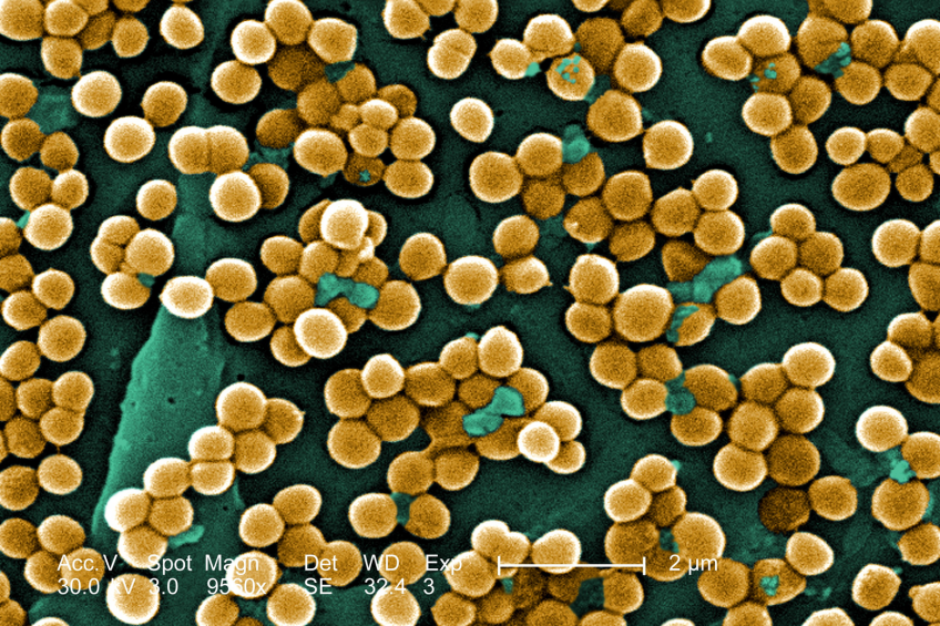 Norway takes firm action against MRSA