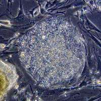 Pig organs used to regenerate tissue