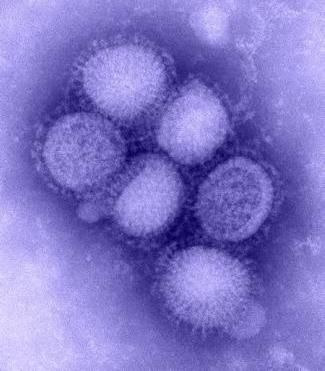 H1N1 found in several Manitoba herds