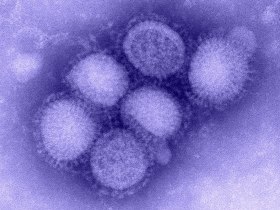 Hong Kong: flu reassorts with H1N1 from pig