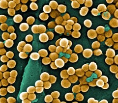 Study suggests origins of MRSA strain in food animals