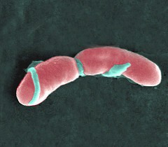 Source of listeria NZ outbreak hard to identify