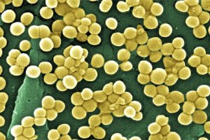 Danish report slight increase in pig-related MRSA in humans