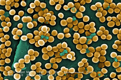MRSA bacteria when viewed through a microscope. - Photo: CDC/ Janice Haney Carr