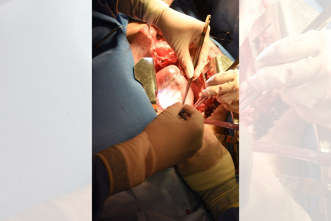 The pig heart before it was surgically removed from the pig. - Photo: University of Maryland